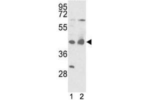 Western Blotting (WB) image for anti-Isocitrate Dehydrogenase 1 (NADP+), Soluble (IDH1) (AA 63-90) antibody (ABIN3031507)