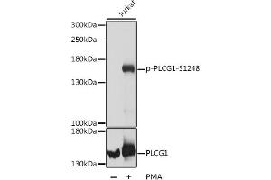 Western blot analysis of extracts of Jurkat cells, using Phospho-PLC gamma 1 (PLCG1)-S1248 antibody (ABIN7269347) at dilution or PLC gamma 1 (PLCG1) antibody . (Phospholipase C gamma 1 抗体  (pSer1248))