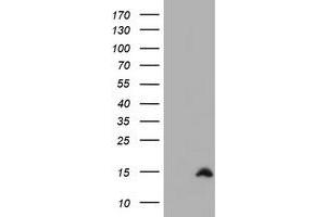 Image no. 1 for anti-Cystatin SA (CST2) antibody (ABIN1497760) (CST2 抗体)