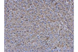 IHC-P Image Immunohistochemical analysis of paraffin-embedded Hela xenograft, using Siglec 7, antibody at 1:500 dilution. (SIGLEC7 抗体)