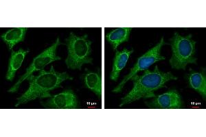 ICC/IF Image DECR1 antibody [N1C3] detects DECR1 protein at mitochondria by immunofluorescent analysis.