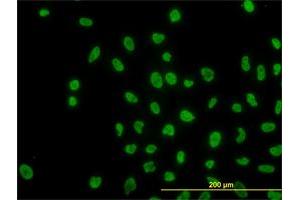 Immunofluorescence (IF) image for anti-AT Rich Interactive Domain 1B (SWI1-Like) (ARID1B) (AA 1364-1460) antibody (ABIN566118)