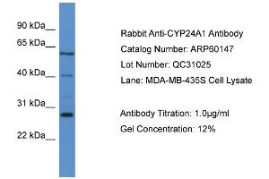 WB Suggested Anti-CYP24A1  Antibody Titration: 0. (CYP24A1 抗体  (C-Term))