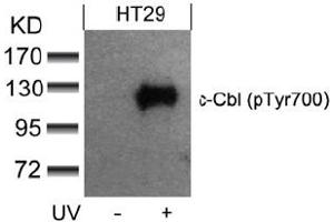 Image no. 3 for anti-Cas-Br-M (Murine) Ecotropic Retroviral Transforming Sequence (CBL) (pTyr700) antibody (ABIN319294) (CBL 抗体  (pTyr700))