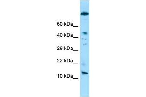 WB Suggested Anti-VCY Antibody Titration: 1. (Variable Charge, Y-Linked (VCY) (N-Term) 抗体)