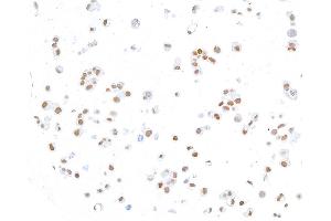 Immunocytochemistry (ICC) image for anti-ThPok (AA 250-300) antibody (ABIN7453988) (Recombinant ThPok (AA 250-300) 抗体)