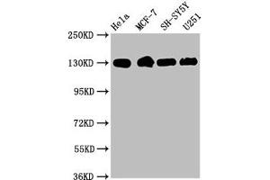 Western Blot Positive WB detected in: Hela whole cell lysate, MCF-7 whole cell lysate, SH-SY5Y whole cell lysate, U251 whole cell lysate All lanes: Integrin beta-1/CD29 antibody at 1. (Recombinant ITGB1 抗体)