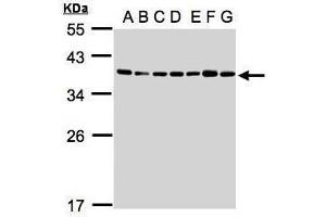 WB Image Sample(30μg whole cell lysate) A: 293T B: A431 , C: H1299 D: HeLa S3 , E: Hep G2 , F: MOLT4 , G: Raji , 12% SDS PAGE antibody diluted at 1:1000 (U2AF1 抗体)