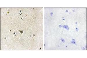 Immunohistochemistry analysis of paraffin-embedded human brain tissue, using LRRK1 Antibody. (LRRK1 抗体  (AA 361-410))