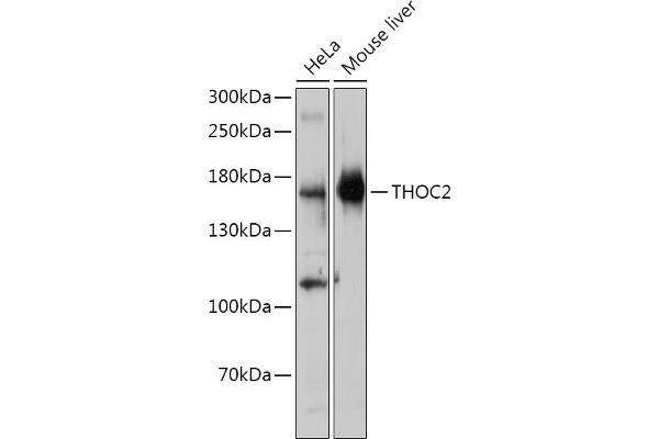 THO Complex 2 抗体