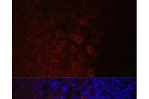 Immunofluorescence analysis of Rat brain using NEFH Polyclonal Antibody at dilution of 1:100. (NEFH 抗体)