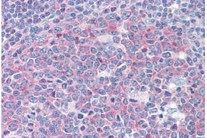 Human Tonsil: Formalin-Fixed, Paraffin-Embedded (FFPE) (FARSB 抗体  (AA 234-342))