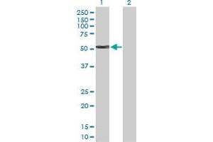Western Blot analysis of KRT4 expression in transfected 293T cell line by KRT4 MaxPab polyclonal antibody. (KRT4 抗体  (AA 1-534))