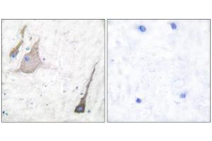 Immunohistochemistry (IHC) image for anti-Synuclein (SYU) (N-Term), (pan) antibody (ABIN1848790) (Synuclein 抗体  (N-Term, pan))