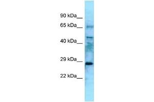 WB Suggested Anti-Eya4 Antibody Titration: 1. (EYA4 抗体  (N-Term))