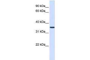 WB Suggested Anti-TXNDC14 Antibody Titration:  0. (TMX2 抗体  (Middle Region))