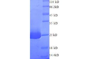 SDS-PAGE (SDS) image for N-Ethylmaleimide-Sensitive Factor (NSF) (AA 7-209), (partial) protein (His tag) (ABIN5712972) (NSF Protein (AA 7-209, partial) (His tag))