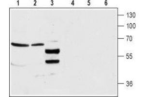 Western Blotting (WB) image for anti-gamma-aminobutyric Acid (GABA) A Receptor, alpha 4 (GABRA4) (AA 37-50), (Extracellular) antibody (ABIN7043188)
