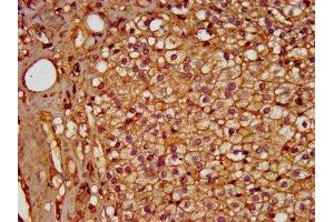 IHC image of ABIN7155179 diluted at 1:600 and staining in paraffin-embedded human adrenal gland tissue performed on a Leica BondTM system. (PDE9A 抗体  (AA 426-533))