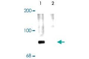 Western blot of rat cortex lysate showing specific labeling of the ~78k Syn1 protein phosphorylated at Ser 62,67 (Control). (SYN1 抗体  (pSer62, pSer67))