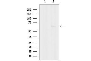 anti-CaMK2 beta/gamma antibody