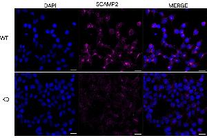 Immunocytochemical staining of HeLa cells using SCAMP2 antibody (ABIN7800289), 1:1,000), Top panel: wild-type (WT), Bottom panal: SCAMP2 shRNA knockdown (KD). (SCAMP2 抗体)