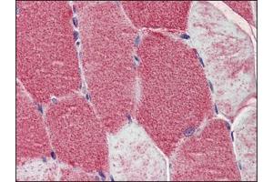 Human Skeletal Muscle: Formalin-Fixed, Paraffin-Embedded (FFPE) (POLG 抗体  (AA 829-1201))