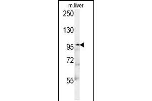 Western blot analysis in mouse liver tissue lysates (15ug/lane). (KIF9 抗体  (C-Term))