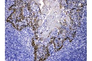 Cytokeratin 14 was detected in paraffin-embedded sections of human tonsil tissues using rabbit anti- Cytokeratin 14 Antigen Affinity purified polyclonal antibody (Catalog # ) at 1 µg/mL. (KRT14 抗体  (C-Term))