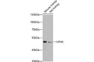 Western blot analysis of extracts of various cell lines, using NTN5 antibody (ABIN6132148, ABIN6144903, ABIN6144904 and ABIN6217109) at 1:3000 dilution. (Netrin 5 抗体  (AA 340-489))