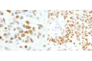 Immunohistochemistry (IHC) image for anti-General Transcription Factor III (GTF2I) (AA 985-998) antibody (ABIN7454740)