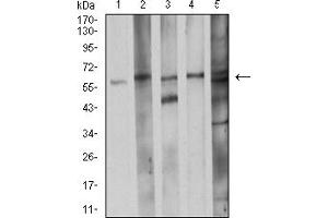 Western Blotting (WB) image for anti-Cell Division Cycle 37 Homolog (S. Cerevisiae) (CDC37) (AA 241-378) antibody (ABIN5918060)