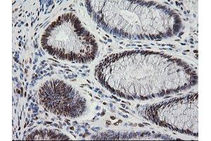 Image no. 6 for anti-Zinc Finger and SCAN Domain Containing 18 (ZSCAN18) antibody (ABIN1501858)