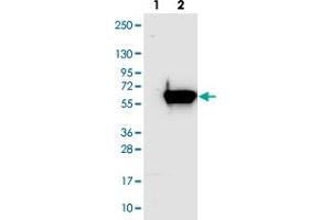 Western blot analysis of Lane 1: Negative control (vector only transfected HEK293T lysate). (AGXT2L1 抗体)