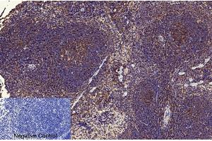 Immunohistochemical analysis of paraffin-embedded mouse spleen tissue. (NF-kB p65 抗体  (acLys310))