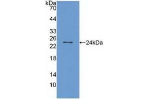 Western Blotting (WB) image for anti-Transient Receptor Potential Cation Channel, Subfamily V, Member 1 (TRPV1) (AA 1-153) antibody (ABIN7436147)