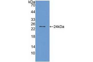 Detection of Recombinant TRPV1, Human using Polyclonal Antibody to Transient Receptor Potential Cation Channel Subfamily V, Member 1 (TRPV1) (TRPV1 抗体  (AA 1-153))