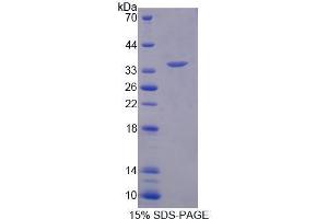 Image no. 1 for Replication Factor C (Activator 1) 2, 40kDa (RFC2) (AA 58-332) protein (His tag) (ABIN6239666) (RFC2 Protein (AA 58-332) (His tag))