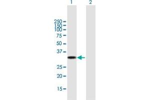 Western Blot analysis of UCP2 expression in transfected 293T cell line by UCP2 MaxPab polyclonal antibody. (UCP2 抗体  (AA 1-309))
