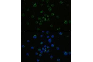 Immunofluorescence analysis of Jurkat cells using CD4 antibody (ABIN6132069, ABIN6138186, ABIN6138188 and ABIN6213820) at dilution of 1:100. (CD4 抗体  (AA 26-200))