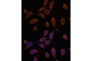 Immunofluorescence (IF) image for anti-SEC23 Interacting Protein (SEC23IP) (AA 600-940) antibody (ABIN7270170)