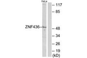 Western blot analysis of extracts from HeLa cells, using ZNF436 Antibody. (ZNF436 抗体  (AA 71-120))