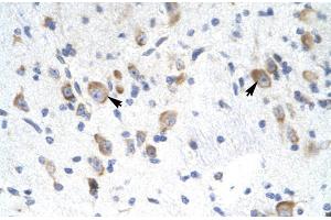 Rabbit Anti-GTF2F2 Antibody Catalog Number: ARP31437 Paraffin Embedded Tissue: Human Brain Cellular Data: Neural Cells Antibody Concentration: 4. (GTF2F2 抗体  (Middle Region))