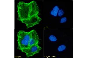 Immunofluorescence staining of Caco-2 cells using anti-EpCAM. (Recombinant EpCAM 抗体)