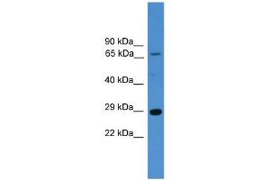 Western Blotting (WB) image for anti-High Mobility Group Box 1 (HMGB1) (N-Term) antibody (ABIN2787911)