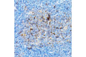 Immunohistochemistry of paraffin-embedded mouse spleen using SI antibody (ABIN3016131, ABIN3016132, ABIN3016133 and ABIN6219568) at dilution of 1:100 (40x lens). (SIAH1 抗体  (AA 1-313))
