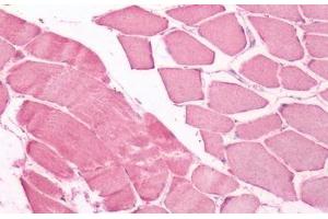 Human Skeletal Muscle: Formalin-Fixed, Paraffin-Embedded (FFPE) (UCHL3 抗体  (Internal Region))