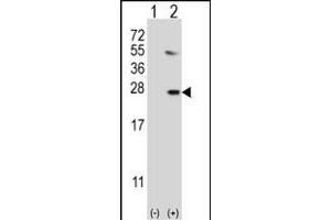 Western blot analysis of UBE2G1 (arrow) using rabbit polyclonal UBE2G1 Antibody (R11) (ABIN388859 and ABIN2839161). (UBE2G1 抗体  (N-Term))