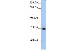 CHST14 antibody used at 1 ug/ml to detect target protein. (CHST14 抗体)