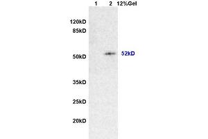 L1 rat brain lysates L2 rat intestine lysates probed with Anti Desmin/DES Polyclonal Antibody, Unconjugated (ABIN736566) at 1:200 overnight at 4 °C. (Desmin 抗体  (AA 261-360))